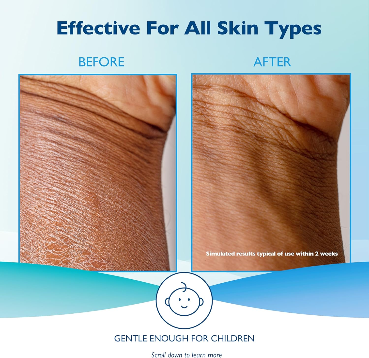 Glaxal Base Moisturizing Lotion, 227g/7.9 oz